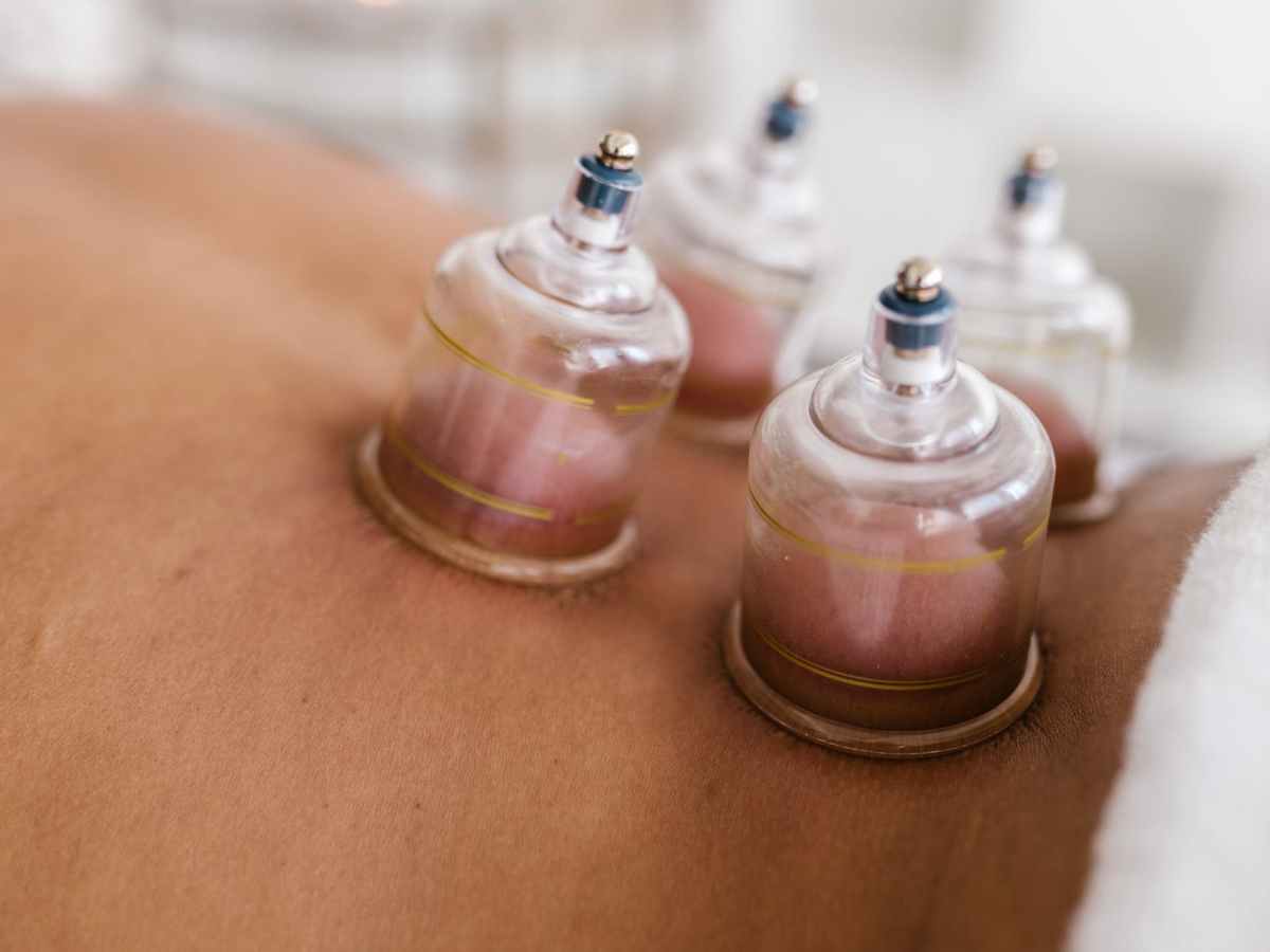 Massage Cupping Class